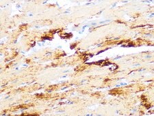 Anti-Myosin heavy chain Antibody, clone 6V0G1, Rabbit Monoclonal
