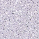 Anti-CYP11B2 antibody produced in rabbit Prestige Antibodies&#174; Powered by Atlas Antibodies, affinity isolated antibody, buffered aqueous glycerol solution