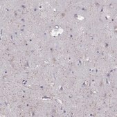 Anti-GRIK4 Prestige Antibodies&#174; Powered by Atlas Antibodies, affinity isolated antibody