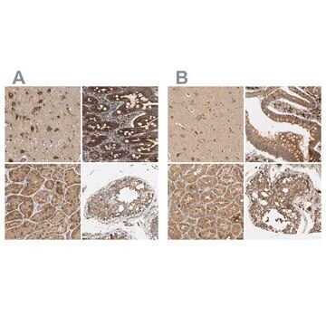 Anti-MRPS22 antibody produced in rabbit Prestige Antibodies&#174; Powered by Atlas Antibodies, affinity isolated antibody, buffered aqueous glycerol solution