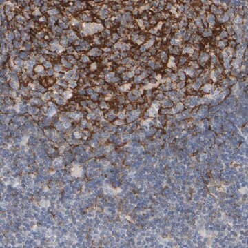 Anti-EPHX2 antibody produced in rabbit Prestige Antibodies&#174; Powered by Atlas Antibodies, affinity isolated antibody, buffered aqueous glycerol solution, Ab2