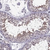 Anti-DDX20 antibody produced in rabbit Prestige Antibodies&#174; Powered by Atlas Antibodies, affinity isolated antibody, buffered aqueous glycerol solution
