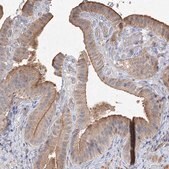 Anti-GRINA antibody produced in rabbit Prestige Antibodies&#174; Powered by Atlas Antibodies, affinity isolated antibody, buffered aqueous glycerol solution