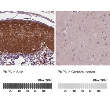 Anti-PKP3 antibody produced in rabbit Prestige Antibodies&#174; Powered by Atlas Antibodies, affinity isolated antibody, buffered aqueous glycerol solution