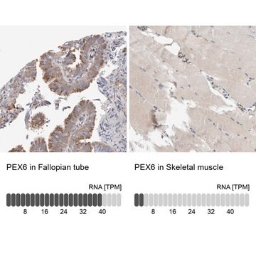 Anti-PEX6 antibody produced in rabbit Prestige Antibodies&#174; Powered by Atlas Antibodies, affinity isolated antibody, buffered aqueous glycerol solution