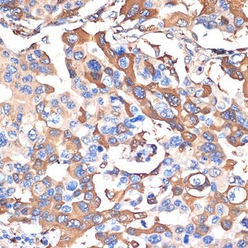 Anti-VPS28 antibody produced in rabbit