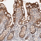Anti-CA13 antibody produced in rabbit Prestige Antibodies&#174; Powered by Atlas Antibodies, affinity isolated antibody, buffered aqueous glycerol solution
