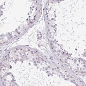 Anti-CACNA1S antibody produced in rabbit Prestige Antibodies&#174; Powered by Atlas Antibodies, affinity isolated antibody, buffered aqueous glycerol solution