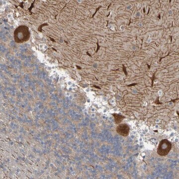 Anti-NAV2 antibody produced in rabbit Prestige Antibodies&#174; Powered by Atlas Antibodies, affinity isolated antibody, buffered aqueous glycerol solution