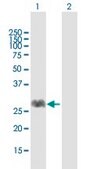 Anti-FNTA antibody produced in mouse purified immunoglobulin, buffered aqueous solution