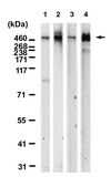 Anti-HSPG2 Antibody, clone 1M17 ZooMAb&#174; Rabbit Monoclonal recombinant, expressed in HEK 293 cells