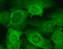 Monoclonal Anti-CACNB2 antibody produced in mouse clone S8B-1, 1&#160;mg/mL, purified immunoglobulin