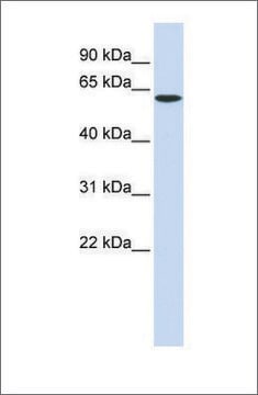 Anti-SPTLC1 antibody produced in rabbit affinity isolated antibody