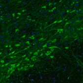 Monoclonal Anti-DDC antibody produced in mouse Prestige Antibodies&#174; Powered by Atlas Antibodies, clone CL2962, purified immunoglobulin, buffered aqueous glycerol solution