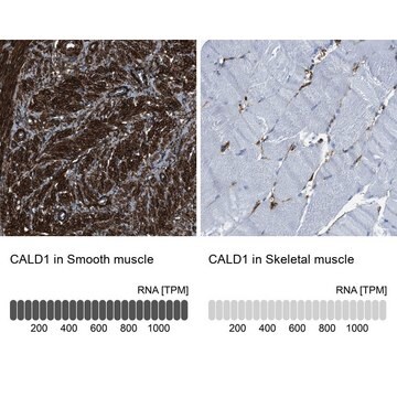 Anti-CALD1 antibody produced in rabbit Prestige Antibodies&#174; Powered by Atlas Antibodies, affinity isolated antibody, buffered aqueous glycerol solution