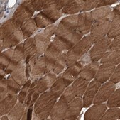 Anti-KCNJ2 antibody produced in rabbit Prestige Antibodies&#174; Powered by Atlas Antibodies, affinity isolated antibody, buffered aqueous glycerol solution