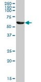 Anti-CAT antibody produced in mouse purified immunoglobulin, buffered aqueous solution