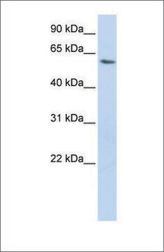 Anti-LSM14A (ab1) antibody produced in rabbit affinity isolated antibody