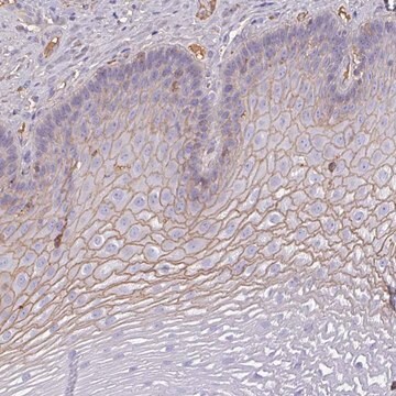 Anti-SMYD5 antibody produced in rabbit Prestige Antibodies&#174; Powered by Atlas Antibodies, affinity isolated antibody, buffered aqueous glycerol solution