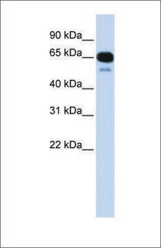 Anti-SLC22A8 antibody produced in rabbit affinity isolated antibody