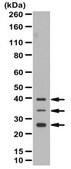 Anti-VEGF-B Antibody 1&#160;mg/mL, from rabbit