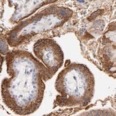 Anti-PLAT antibody produced in rabbit Prestige Antibodies&#174; Powered by Atlas Antibodies, affinity isolated antibody, buffered aqueous glycerol solution