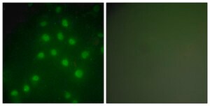 Anti-HDAC9 antibody produced in rabbit affinity isolated antibody