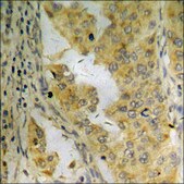 Anti-phospho-PI3-kinase p85-&#945;/&#947; (pTyr467/199) antibody produced in rabbit affinity isolated antibody