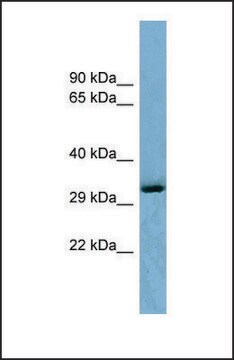 Anti-OTUD6B antibody produced in rabbit affinity isolated antibody