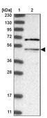 Anti-MLYCD antibody produced in rabbit Prestige Antibodies&#174; Powered by Atlas Antibodies, affinity isolated antibody, buffered aqueous glycerol solution