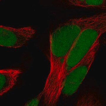 Anti-Hmgb1 Antibody Produced In Rabbit Prestige Antibodies&#174; Powered by Atlas Antibodies, affinity isolated antibody, buffered aqueous glycerol solution