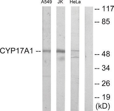 Anti-Cytochrome P450 17A1 antibody produced in rabbit affinity isolated antibody