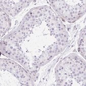 Anti-KCNN4 antibody produced in rabbit Prestige Antibodies&#174; Powered by Atlas Antibodies, affinity isolated antibody, buffered aqueous glycerol solution