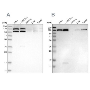 Anti-XPO5 antibody produced in rabbit Prestige Antibodies&#174; Powered by Atlas Antibodies, affinity isolated antibody, buffered aqueous glycerol solution, ab1