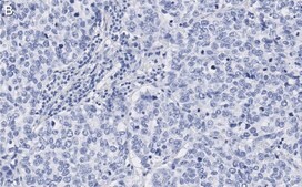 Anti-Skp2 Antibody, clone 1B13 ZooMAb&#174; Rabbit Monoclonal recombinant, expressed in HEK 293 cells