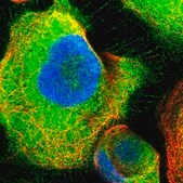 Anti-ATIC antibody produced in rabbit Prestige Antibodies&#174; Powered by Atlas Antibodies, affinity isolated antibody, buffered aqueous glycerol solution