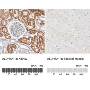 Anti-ALDH7A1 antibody produced in rabbit Prestige Antibodies&#174; Powered by Atlas Antibodies, affinity isolated antibody, buffered aqueous glycerol solution