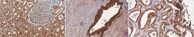 Anti-PSMD9 Antibody, clone 16C5.1 clone 16C5.1, from mouse