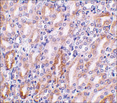 Anti-CAD (ab2) antibody produced in rabbit affinity isolated antibody, buffered aqueous solution