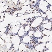Anti-FGR antibody produced in rabbit Prestige Antibodies&#174; Powered by Atlas Antibodies, affinity isolated antibody, buffered aqueous glycerol solution
