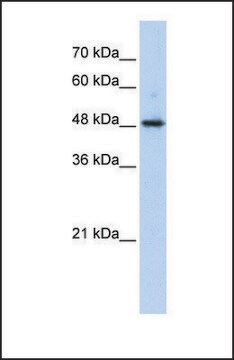 Anti-ABHD2 antibody produced in rabbit affinity isolated antibody