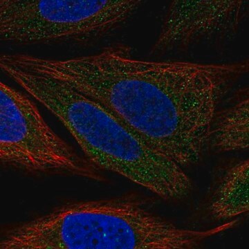 Anti-Pdpk1 Antibody Produced In Rabbit Prestige Antibodies&#174; Powered by Atlas Antibodies, affinity isolated antibody, buffered aqueous glycerol solution