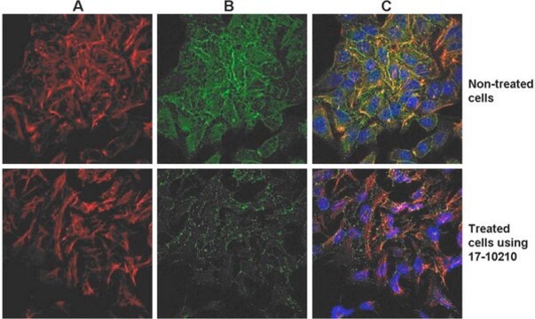 ProteoExtract&#174; Native Cytoskeleton Enrichment The ProteoExtract Native Cytoskeleton Enrichment &amp; Staining Kit provides cytoskeleton purification detergent buffers that retain focal adhesion &amp; actin-associated proteins while removing soluble cytoplasmic &amp; nuclear proteins from the cell.