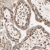 Anti-RBM25 antibody produced in rabbit Prestige Antibodies&#174; Powered by Atlas Antibodies, affinity isolated antibody, buffered aqueous glycerol solution