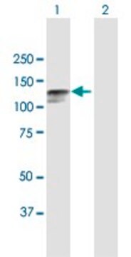 Anti-DSC2 antibody produced in mouse purified immunoglobulin, buffered aqueous solution