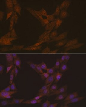 Anti-KIFC1 Antibody, clone 10M10J4, Rabbit Monoclonal