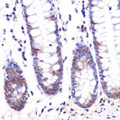 Anti-LXR&#945; antibody produced in rabbit