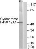 Anti-Cytochrome P450 19A1 antibody produced in rabbit affinity isolated antibody
