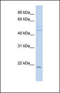 Anti-CIB3, (N-terminal) antibody produced in rabbit affinity isolated antibody