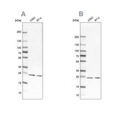 Anti-PSMB1 antibody produced in rabbit affinity isolated antibody, buffered aqueous glycerol solution, ab2